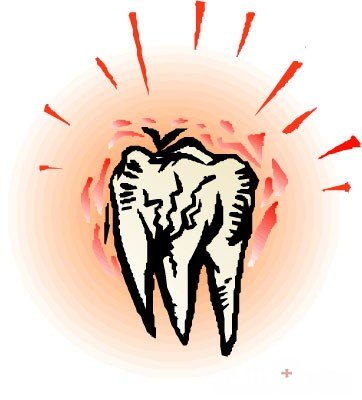 急性牙髓炎怎么治疗