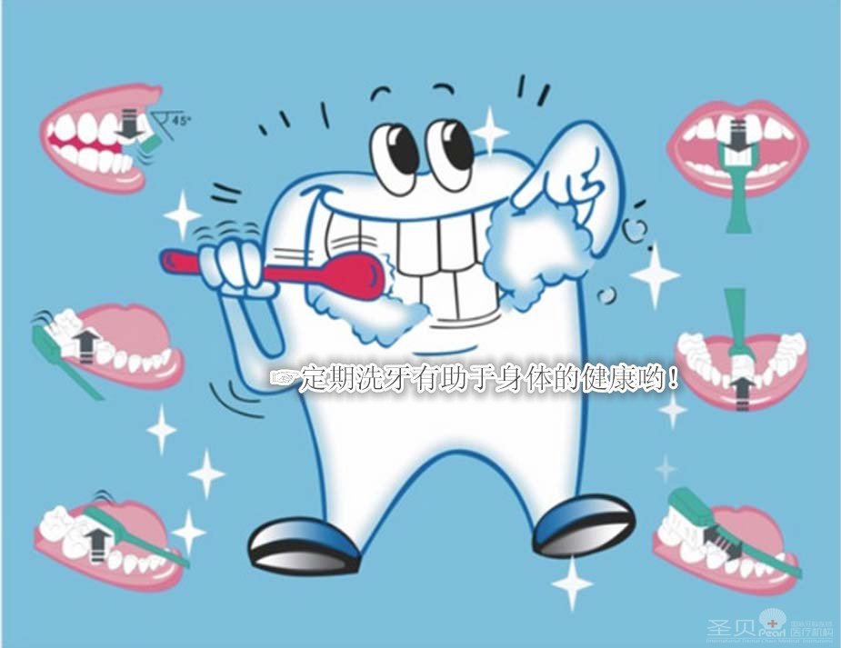 人们为什么要洗牙